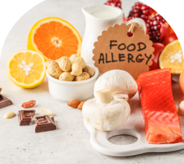 حساسیت‌های غذایی رایج اتیسم