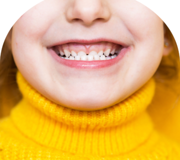 گاز گرفتن کودکان