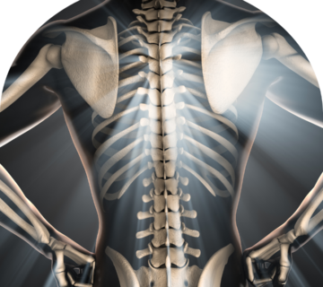 روشهای به تاخیر انداختن روند پوکی استخوان